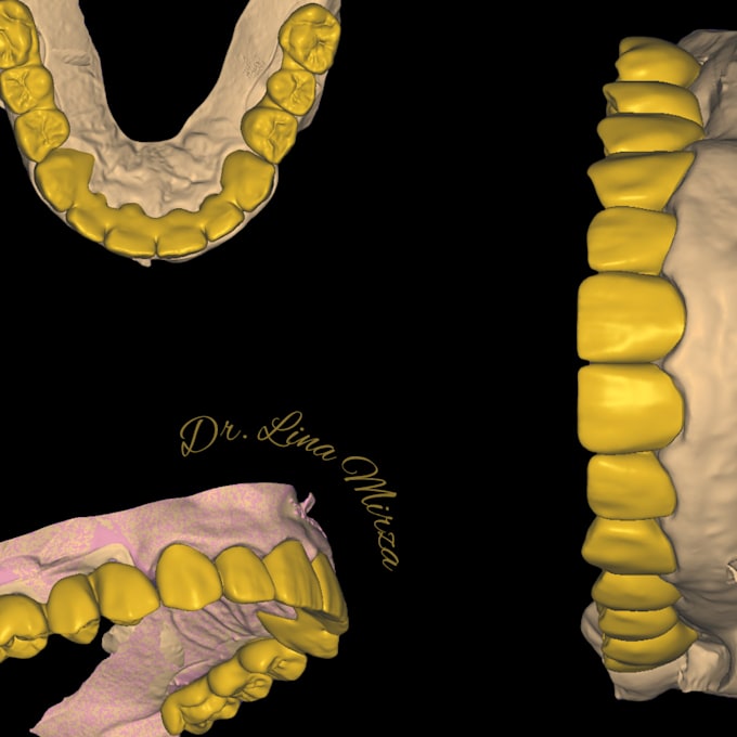 Gig Preview - Design stunning dental restorations and surgical guides