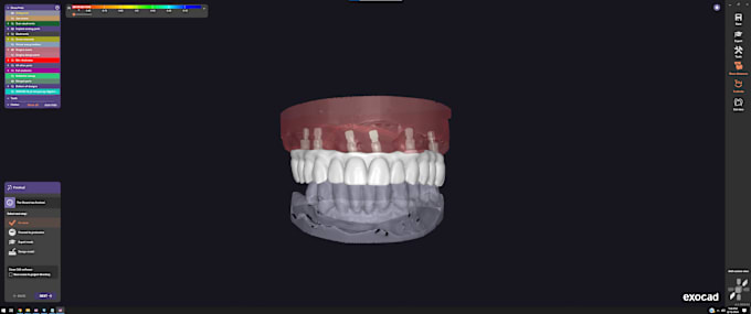 Gig Preview - Design crown and bridge using exocad