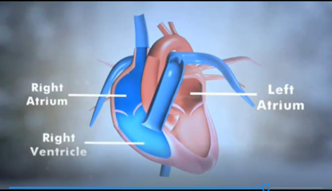 Gig Preview - Create 3d medical animation, 3d human anatomy, human anatomy medical animation