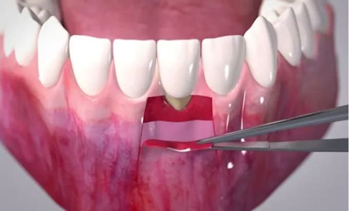 Gig Preview - Do dental or dentist emergency tooth ache animated video