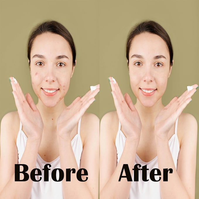 Bestseller - remove things like pimples in the images  please contact us thanks