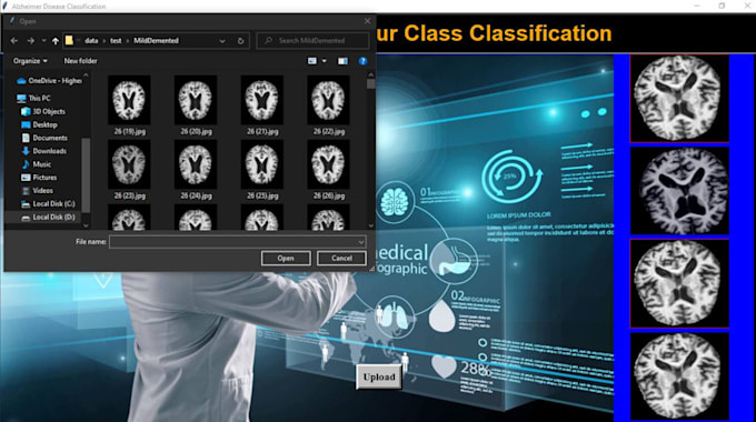 Gig Preview - Mri segmentation and classification of human brain alzheimer disease