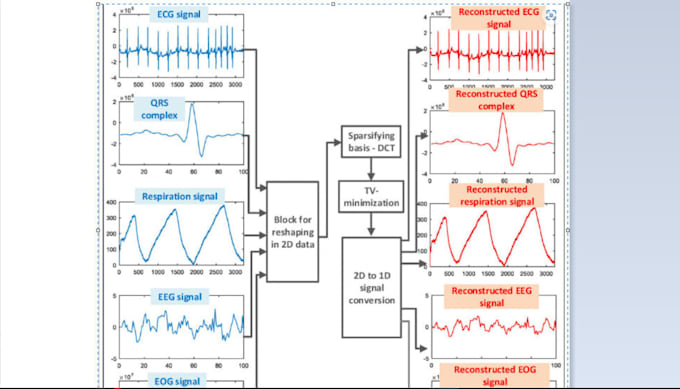 Gig Preview - Assist you in biomedical signal processing and matlab