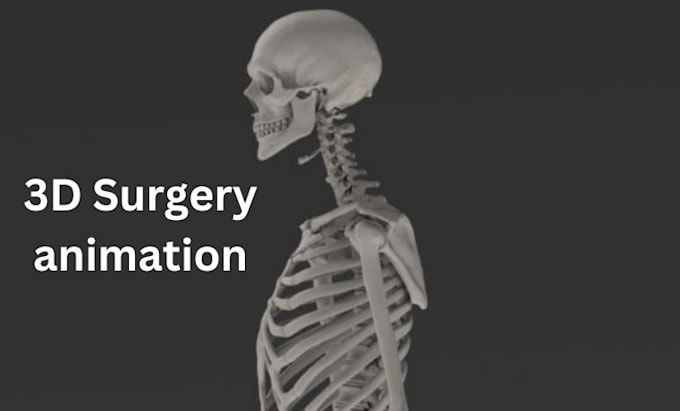 Gig Preview - Create 3d medical animation, 3d surgery animation and 3d dental animation video