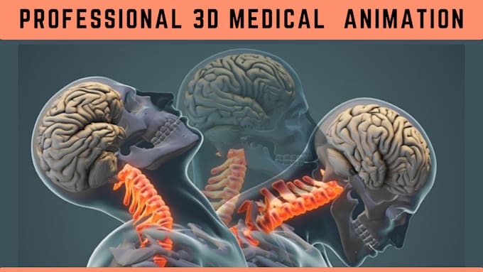 Gig Preview - Do 3d medical animation, 3d surgery animation, and 3d explainer video