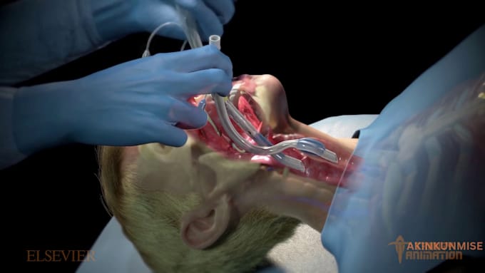 Gig Preview - Do 3d medical animation video for anatomy, 3d medical animation video explainer