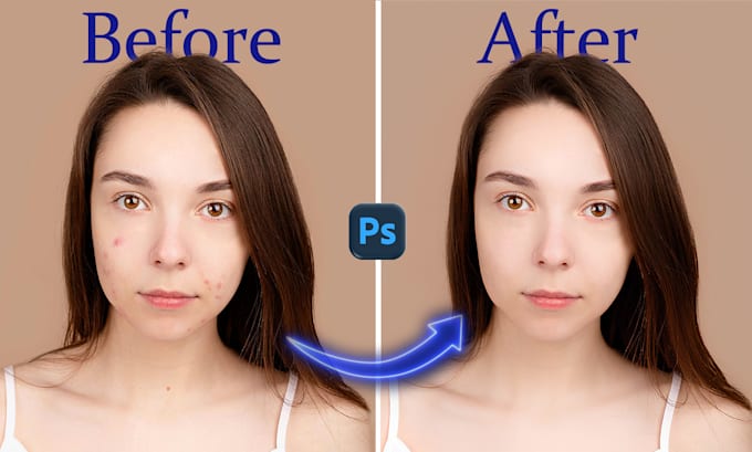 Bestseller - retouch photos, remove acne, scars, smooth skin, teeth