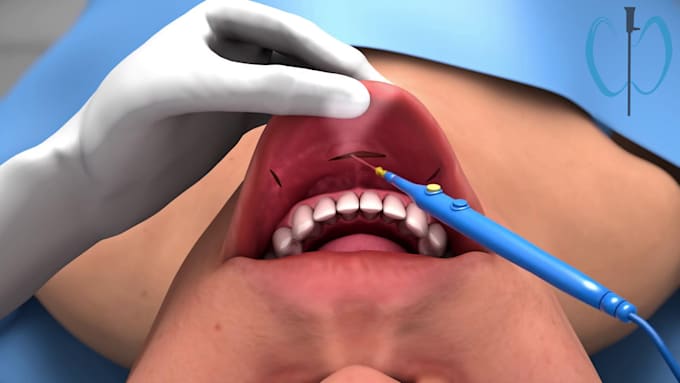 Bestseller - do 3d medical animation video