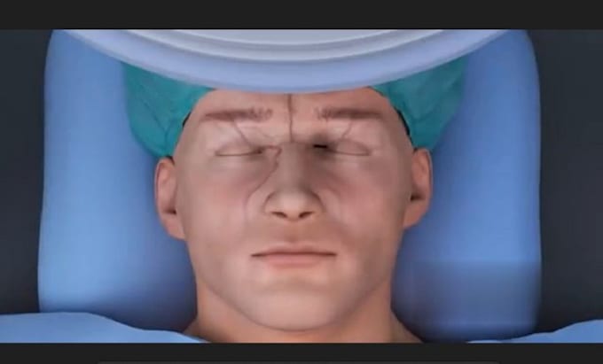 Bestseller - do high quality 3d medical animation, surgery animation, 3d medical explainer