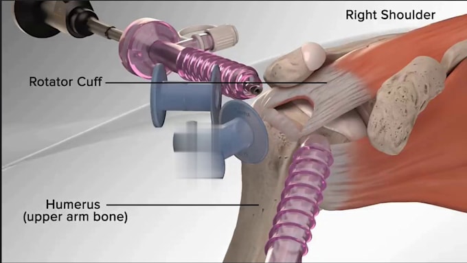 Gig Preview - Create a 3d medical animation and surgery animation for teaching product design