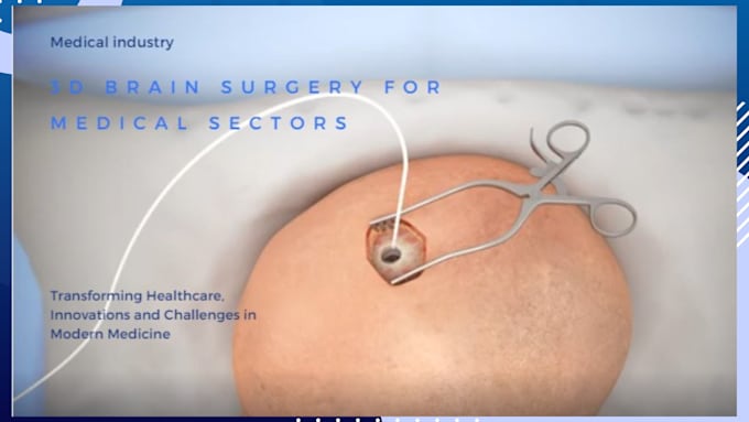 Gig Preview - Create a 4k surgical visually appealing 3d medical animation for medical sector