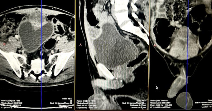 Bestseller - give accurate readings of your radiology examinations