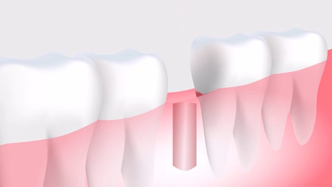 Gig Preview - Create a 3d realistic video for medical animation dental animation