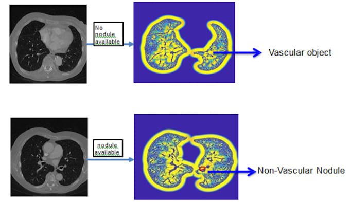 Gig Preview - Image analysis for medical images