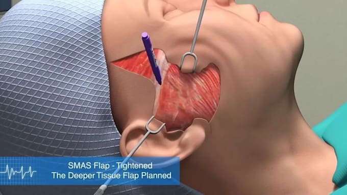 Gig Preview - Create high quality 3d medical animation, 3d dental animation and 3d animation