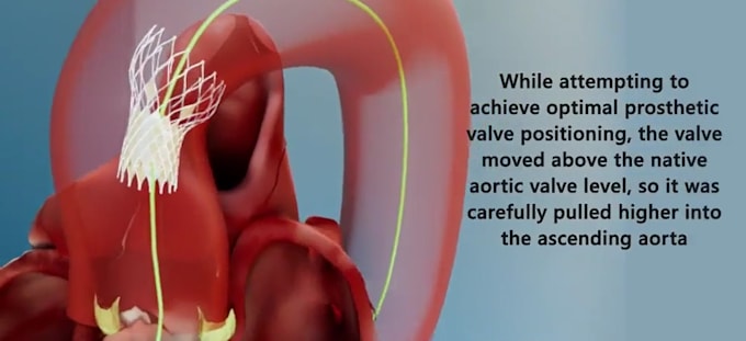 Gig Preview - Do medical animation medical education video healthcare animation anatomy skull