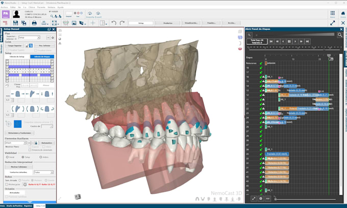 Gig Preview - Treatment planning service for clear aligners