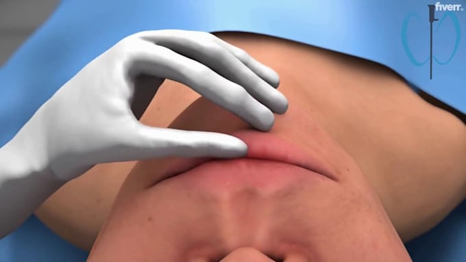 Gig Preview - Create engaging 3d animation for dental treatment and devices