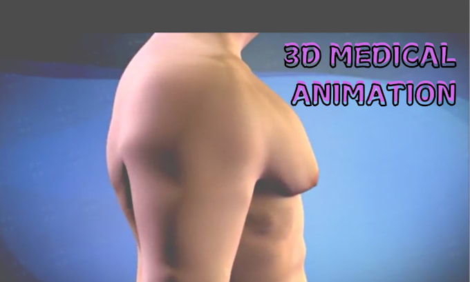 Bestseller - 3d medical animation 3d medical explainer healthcare surgical animation