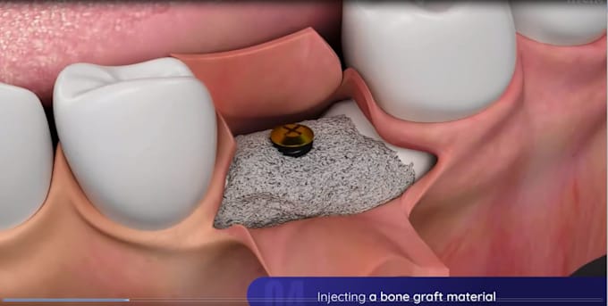 Gig Preview - Make 3d dental medical animation for skeleton, virus, anatomy and surgery video