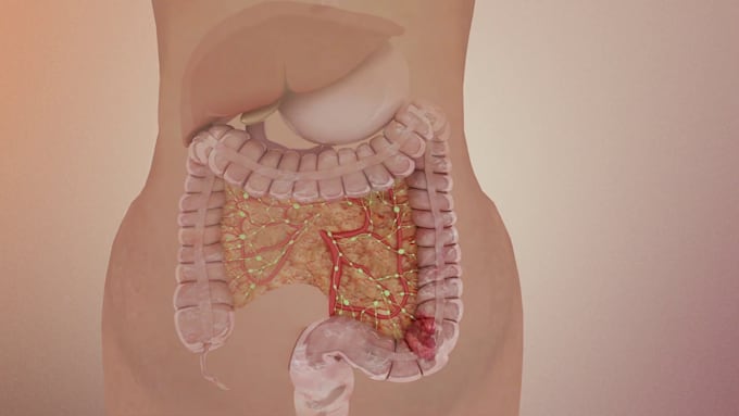 Gig Preview - Create quality 3d medical animation, medical 3d rendering, medical visualization