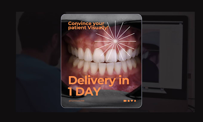 Gig Preview - Design digital smile design customized for your patient