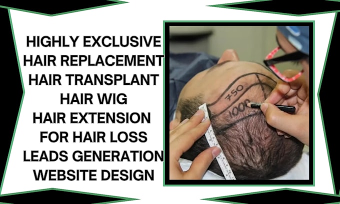 Gig Preview - Generate quality hair placement leads hair transplant hair wig leads and website