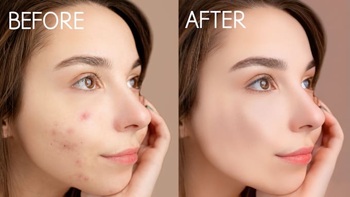 Gig Preview - Do retouching your skin and photo edit in potoshop