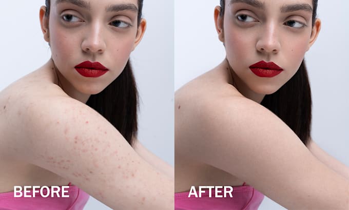 Gig Preview - Remove skin imperfections and improve the skin tone