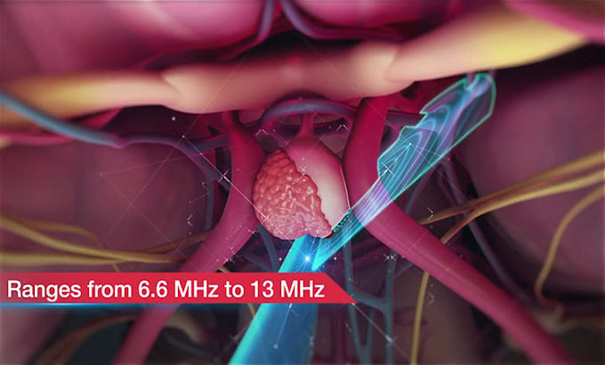 Gig Preview - Create 3d medical animation video 3d medical video  medical surgery 3d animation