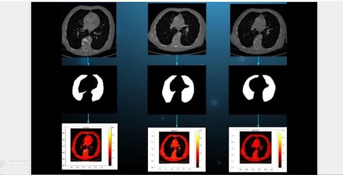 Gig Preview - Do medical image processing using matlab or python