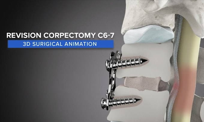 Bestseller - create 3d medical explainer video, 3d surgery animation, and 3d medical video