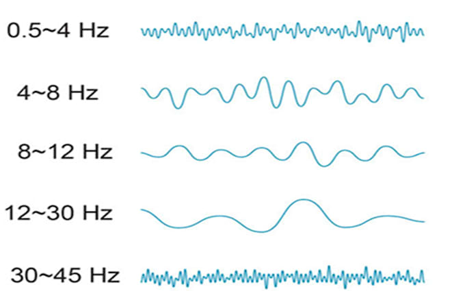 Bestseller - custom eeg or emg signal processing, medical diagnostics