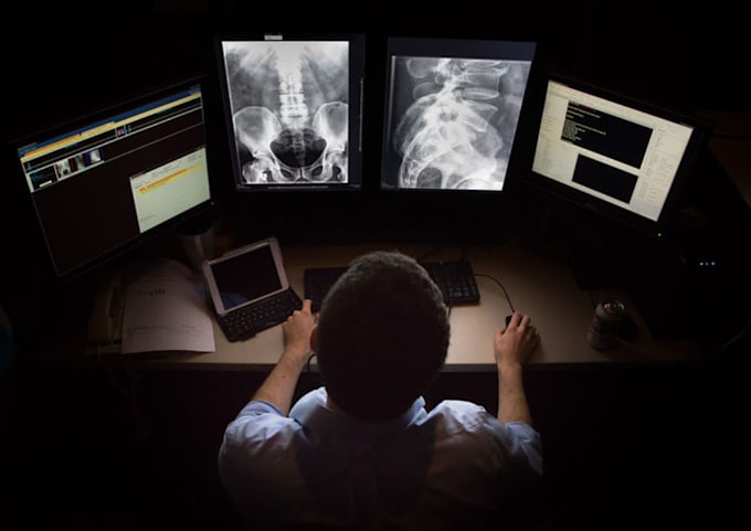 Gig Preview - Provide professional radiology reports with easy explanations