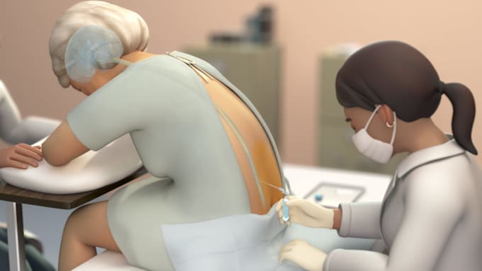 Gig Preview - Medical animation book ,trailer and surgery procedure animation video