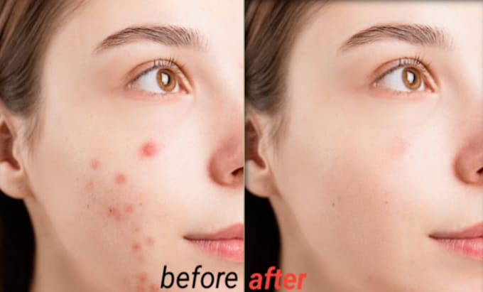 Gig Preview - Remove pimples and retouch skin