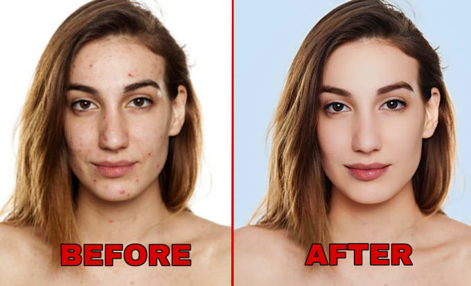 Bestseller - do high end skin retouching and photo touch up