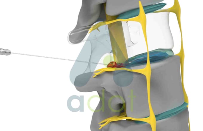 Gig Preview - Do high quality 3d medical animation and modelling