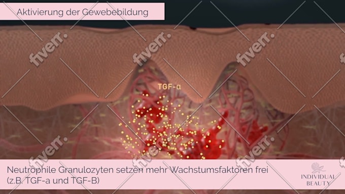 Bild des Arbeitsbeispiels