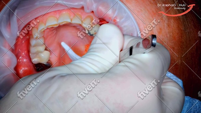 Imagen de muestra de trabajo