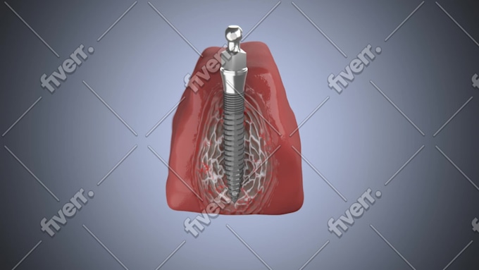 Imagen de muestra de trabajo