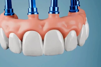 create 3d dental animation, 3d medical video, 3d medical  animation, 3d modeling