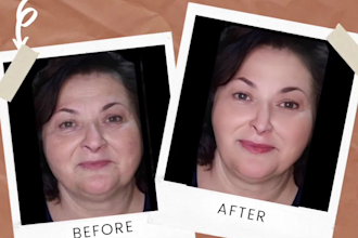 do a plastic surgery photoshop to any part of your face