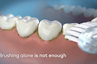 do 3d medical explainer animation 3d dental brace hygiene 3d product brush model