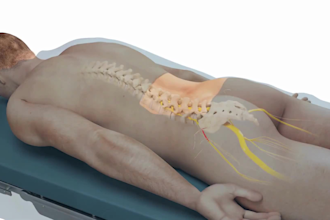 create 3d anatomical animation spine surgery and orthopedic medical device video