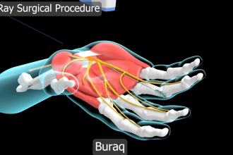 do 3d medical animation for a product or procedure