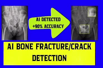 build ai bone fracture detection system with web interface