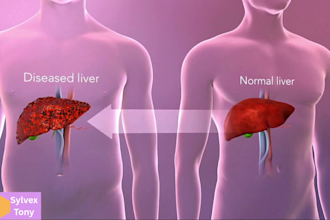 do 3d medical animation 3d surgical animation 3d anatomy explainer video