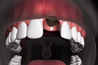 make 3d teeth animation 3d dental video animation 3d orthodontic treatment video