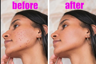 remove pimples and small tattoos from photos